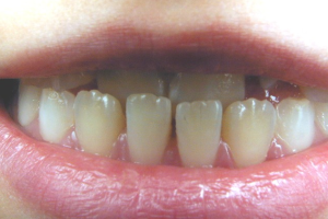 Dr Kim Henry orthodontics